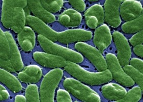 Vibrio vulnificus, the cholera-like bacteria. 