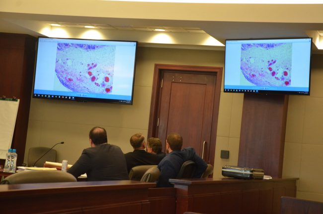 Stanley Wykretowicz and his lawyers look at one of the slides from the little girl's pathology report in the area of her perforated intestine. Click on the image for larger view. (© FlaglerLive)