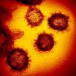 Testing: Novel Coronavirus SARS-CoV-2. (NIH/NIAID)