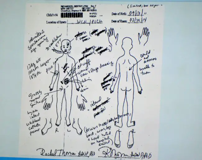 A nurse practitioner's diagram of the alleged victim's condition when the practitioner examined her in 2014. Click on the image for larger view. (© FlaglerLive)