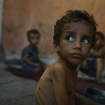 Yazan Abu Ful, a 2-year-old malnourished child, sitting in the Shati refugee camp in Gaza City on July 23, 2025.
