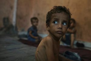 Yazan Abu Ful, a 2-year-old malnourished child, sitting in the Shati refugee camp in Gaza City on July 23, 2025.