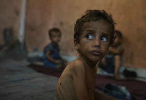 Yazan Abu Ful, a 2-year-old malnourished child, sitting in the Shati refugee camp in Gaza City on July 23, 2025.