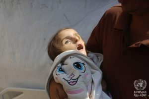 A 4-year-old Palestinian girl, lost her life due to malnutrition and lack of treatment due to the war on Gaza. (Wikimedia Commons