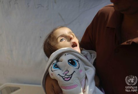 A 4-year-old Palestinian girl, lost her life due to malnutrition and lack of treatment due to the war on Gaza. (Wikimedia Commons