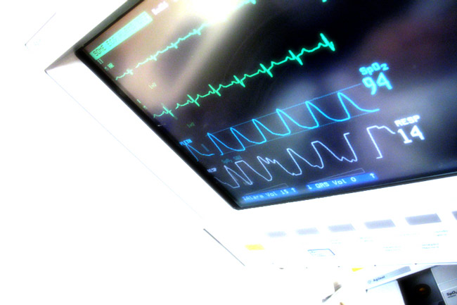 heart-monitor