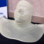 A radiotherapy mask that immobilizes the patient during radiation therapy. (© FlaglerLive)