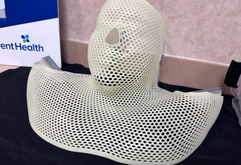 A radiotherapy mask that immobilizes the patient during radiation therapy. (© FlaglerLive)