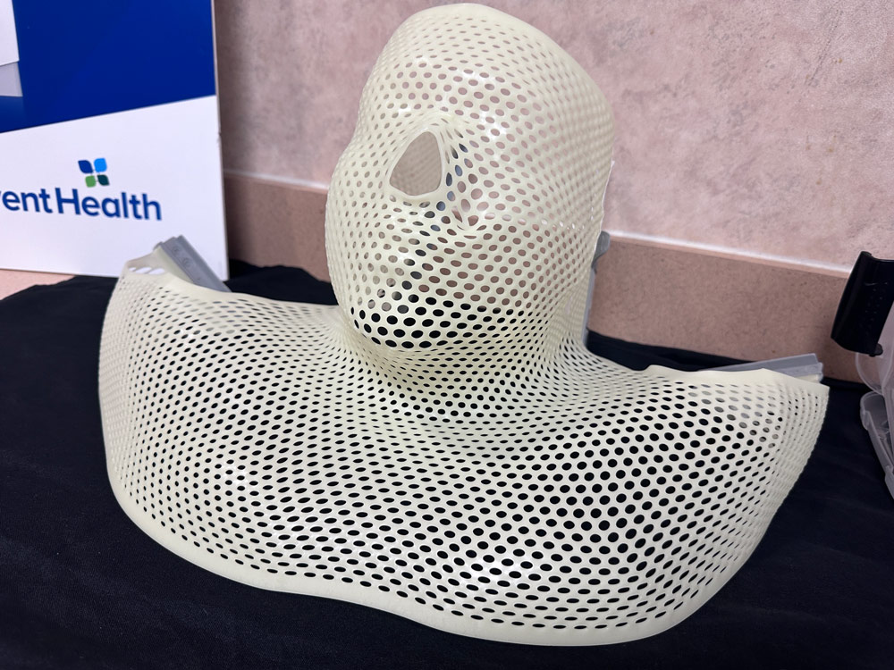 A radiotherapy mask that immobilizes the patient during radiation therapy. (© FlaglerLive)