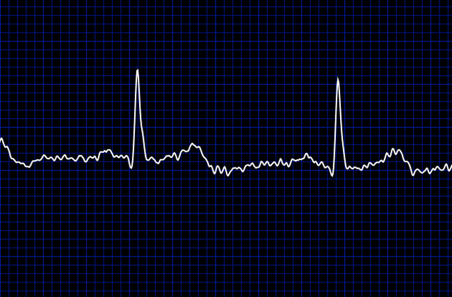 obamacare heartbeat