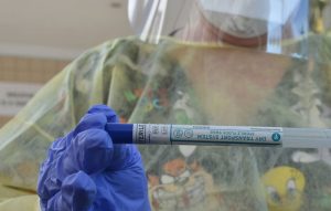 A coronavirus test is not really a test if the result is too late to act on, the author writes. (© FlaglerLive)