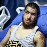 Eighteen-year-old Palestinian Owais Hammam recovers in a hospital after an alleged kidnap and assault by Israeli settlers