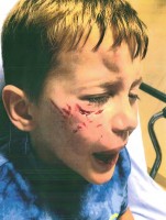 Ricky Westfall before the stitches. Click on the image for larger view. (Flagler County case file.)